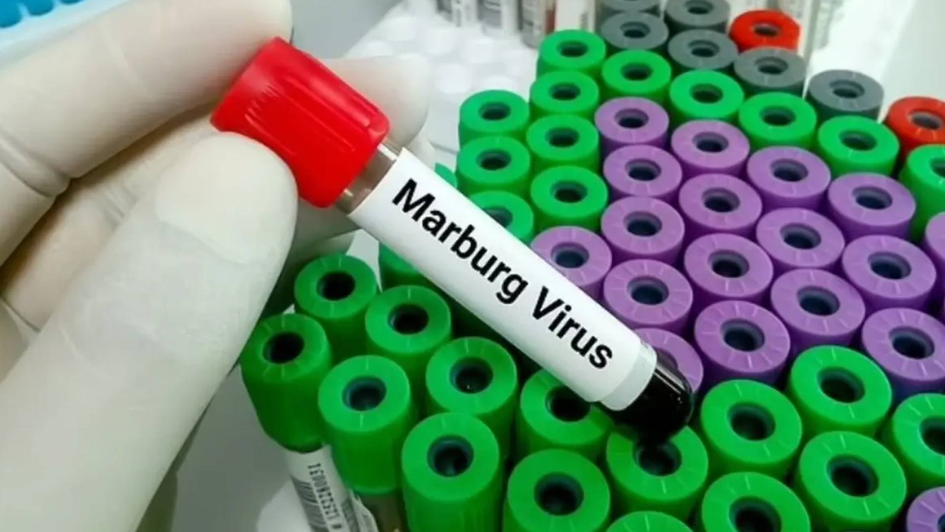 بعد التفشي في إثيوبيا.. إجراءات عاجلة من الصحة لمواجهة فيروس 